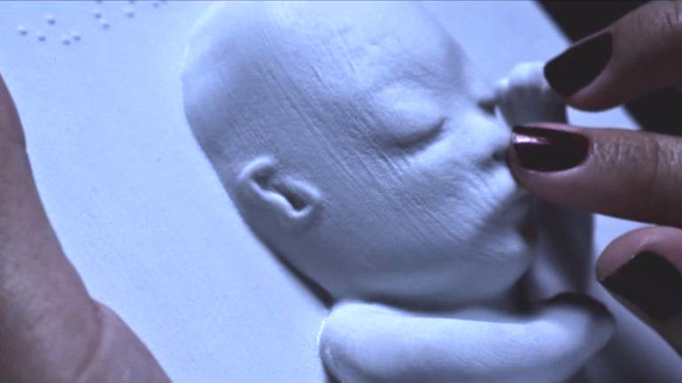 Görme Engelli Hamile Anne 3D Yazıcıyla Bebeğini Hissetti